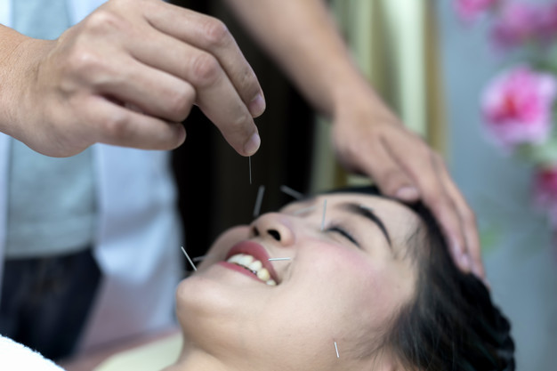 Acupuncture alternative solution for PCOS Syndrome