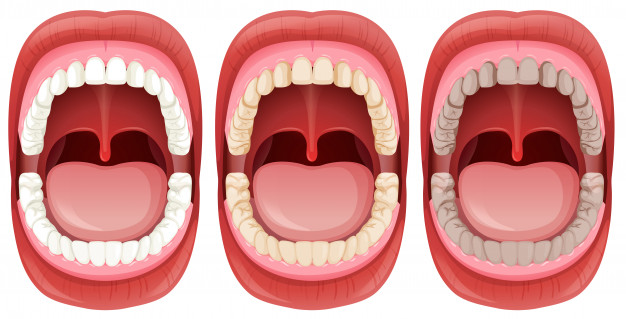 set of human teeth anatomy